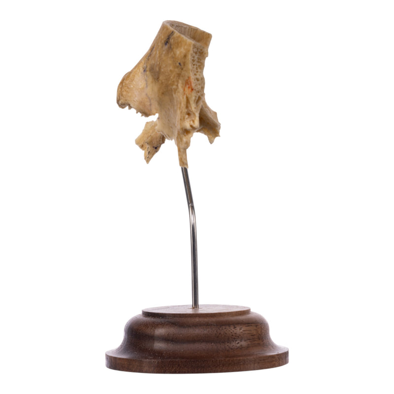 Real Human Partial Skull on Stand