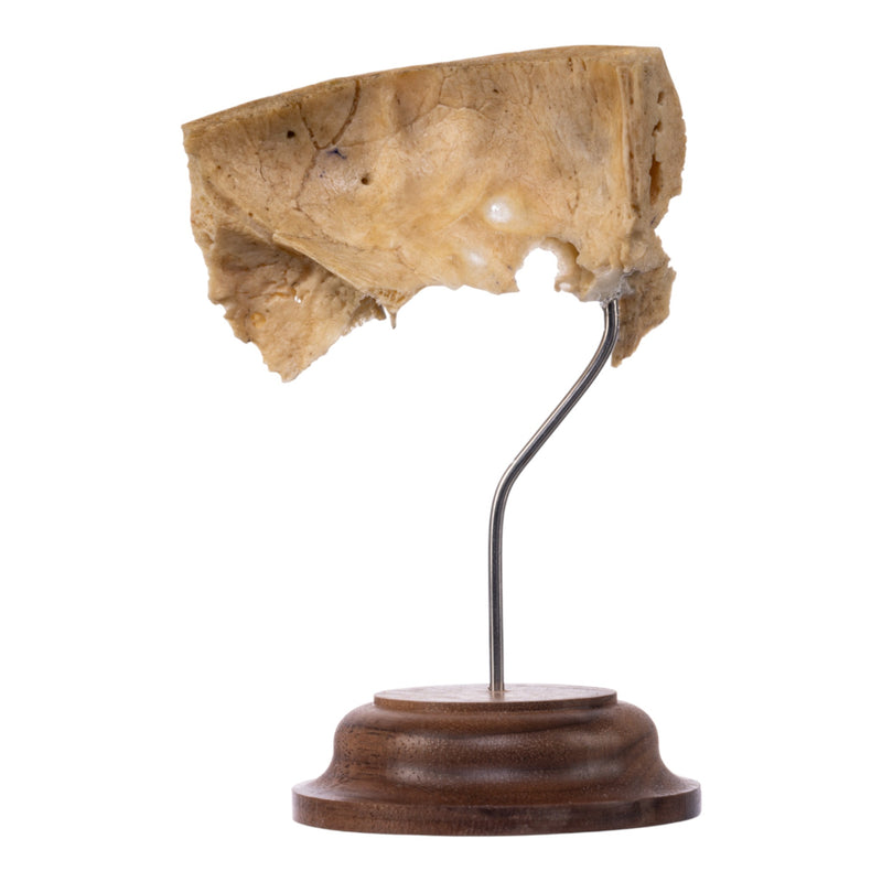 Real Human Partial Skull on Stand
