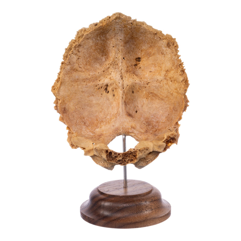 Real Human Partial Skull on Stand