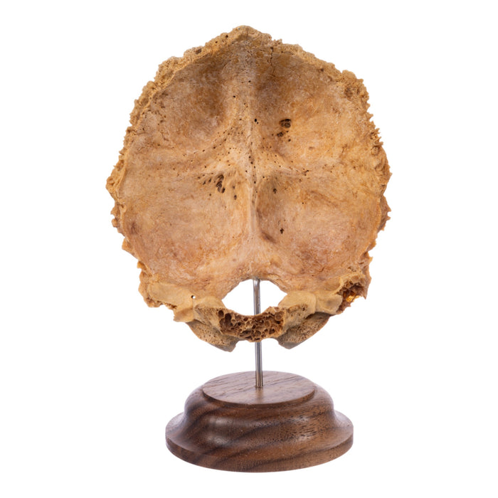 Real Human Partial Skull on Stand