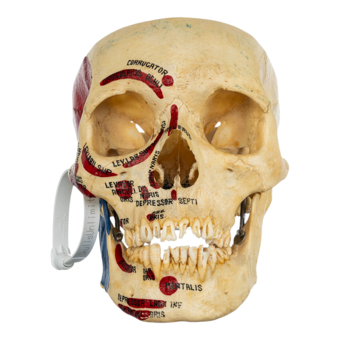 Real Human Skull - Partial, Painted