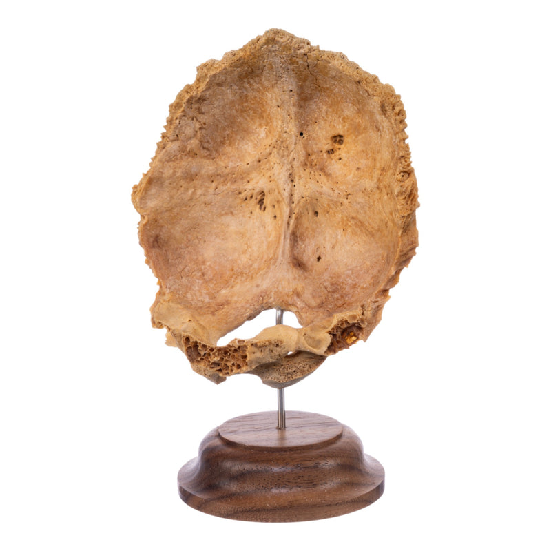 Real Human Partial Skull on Stand