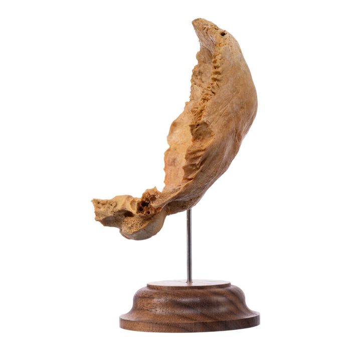 Real Human Partial Skull on Stand