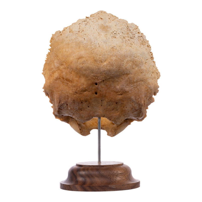 Real Human Partial Skull on Stand