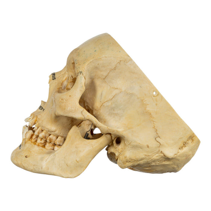 Real Human Skull - Partial, Painted