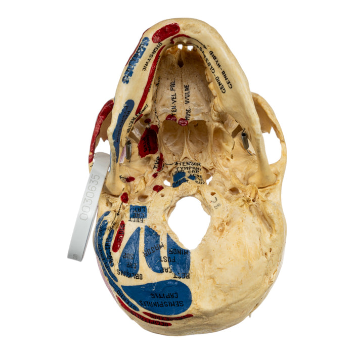 Real Human Skull - Partial, Painted