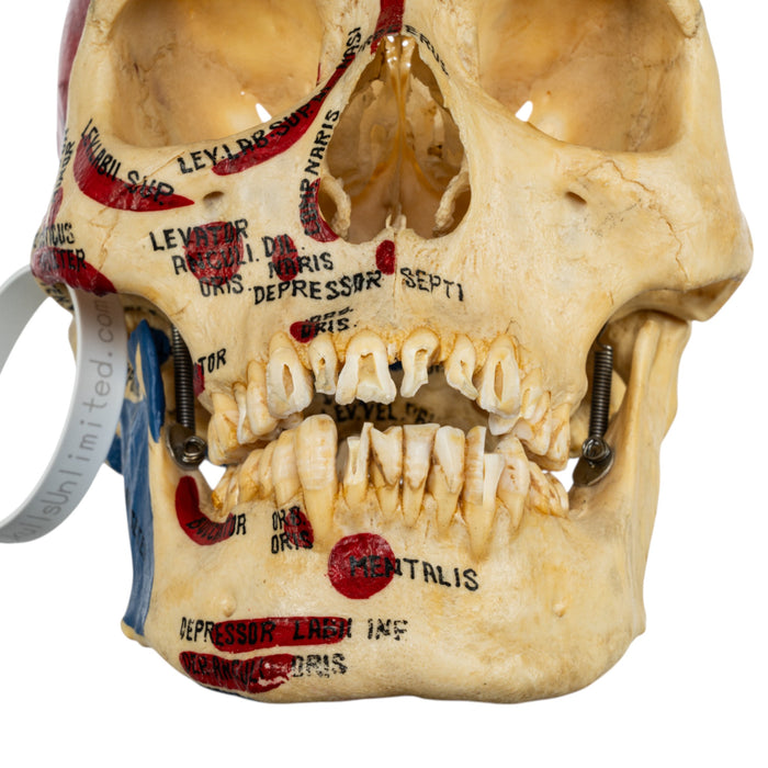 Real Human Skull - Partial, Painted