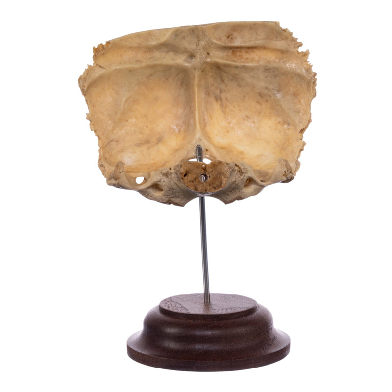 Real Human Partial Skull on Stand
