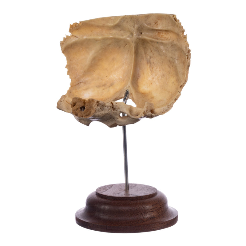 Real Human Partial Skull on Stand