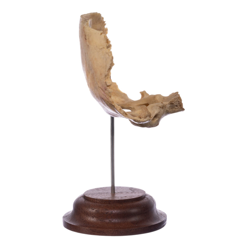 Real Human Partial Skull on Stand