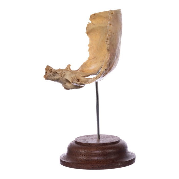 Real Human Partial Skull on Stand
