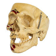 Real Human Skull - Partial, Painted