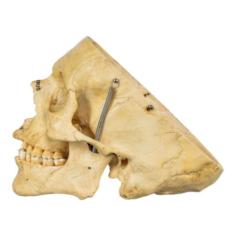 Real Human Skull - Partial, Painted