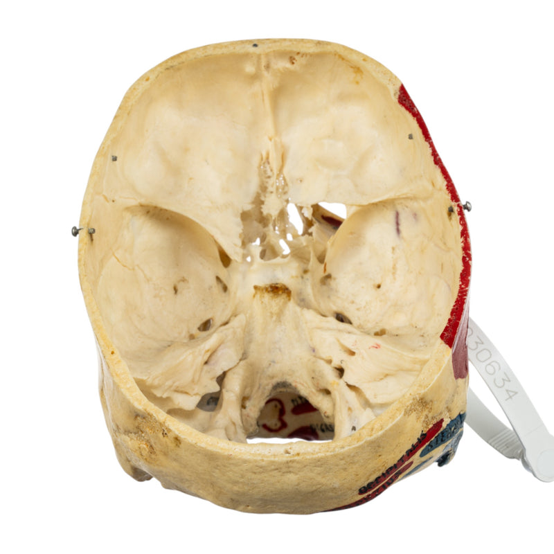 Real Human Skull - Partial, Painted