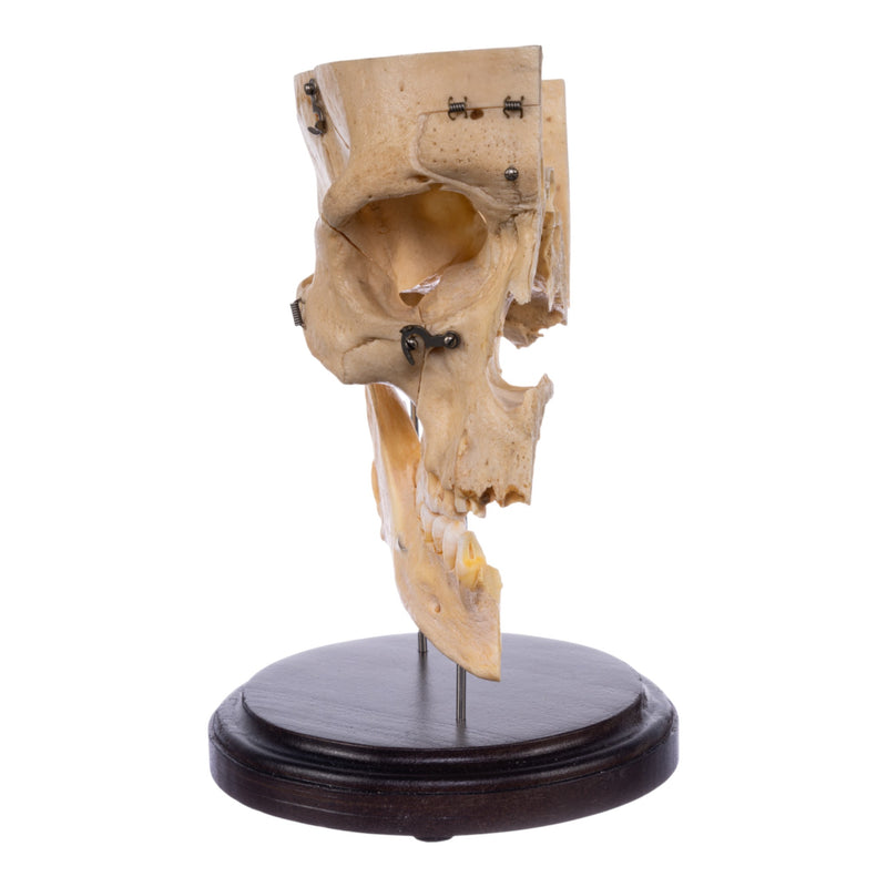 Real Human Partial Skull - Dissected
