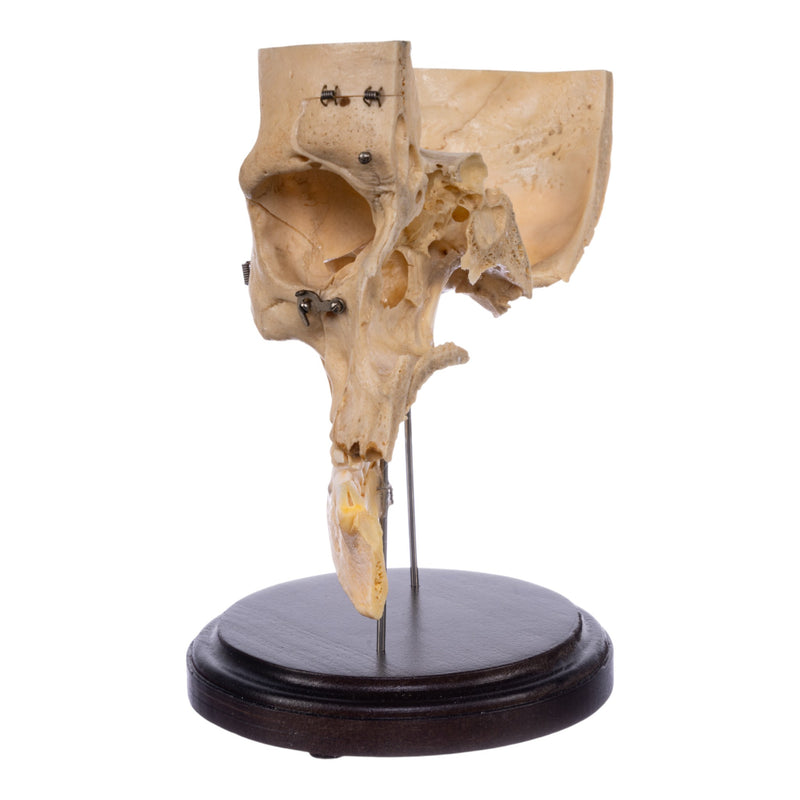 Real Human Partial Skull - Dissected