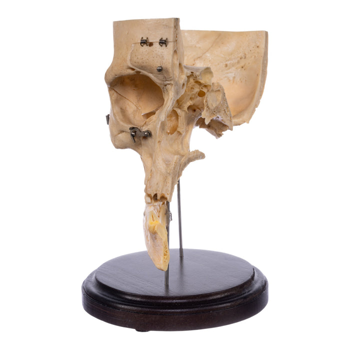 Real Human Partial Skull - Dissected