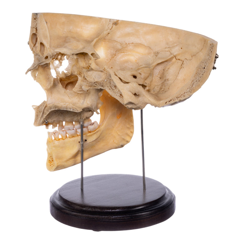 Real Human Partial Skull - Dissected