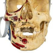 Real Human Skull - Partial, Painted