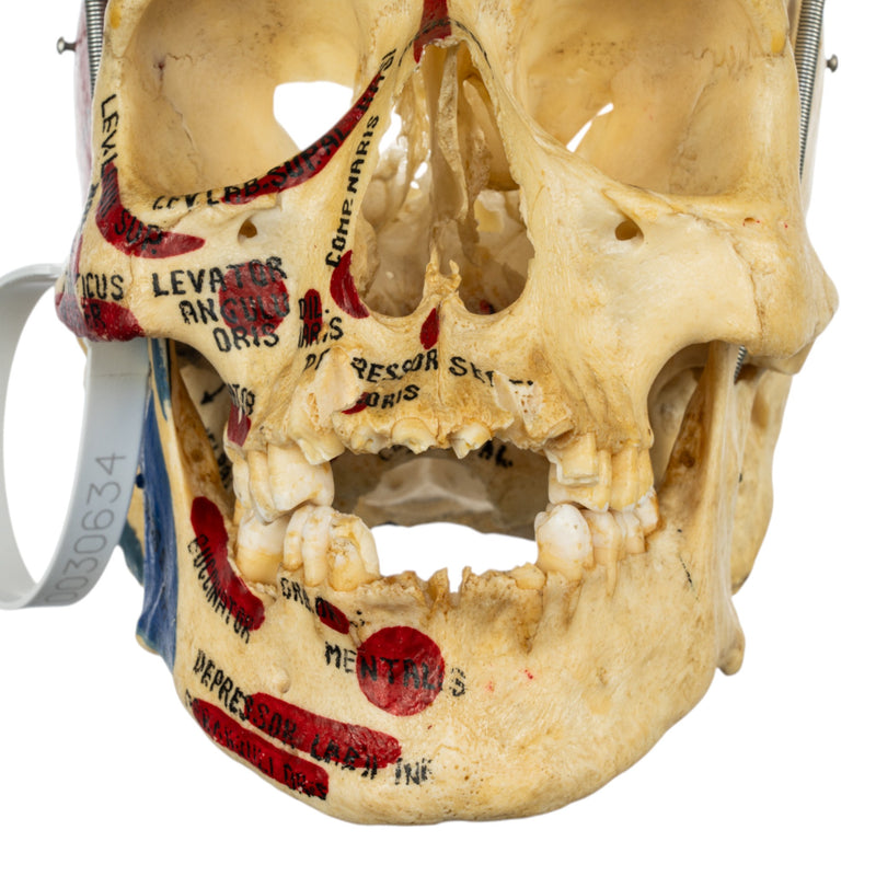 Real Human Skull - Partial, Painted