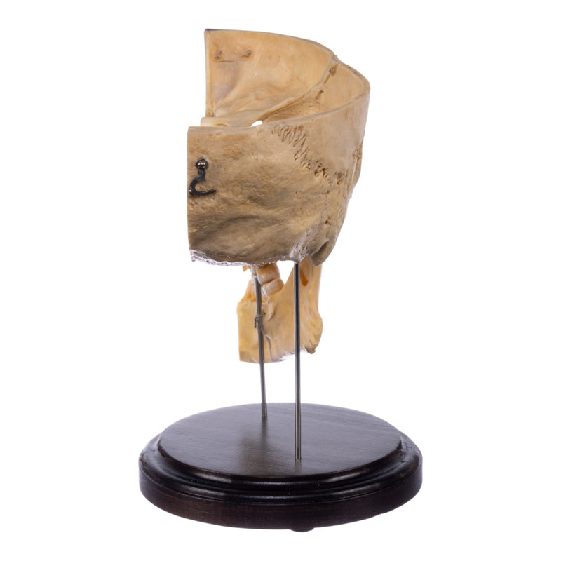 Real Human Partial Skull - Dissected