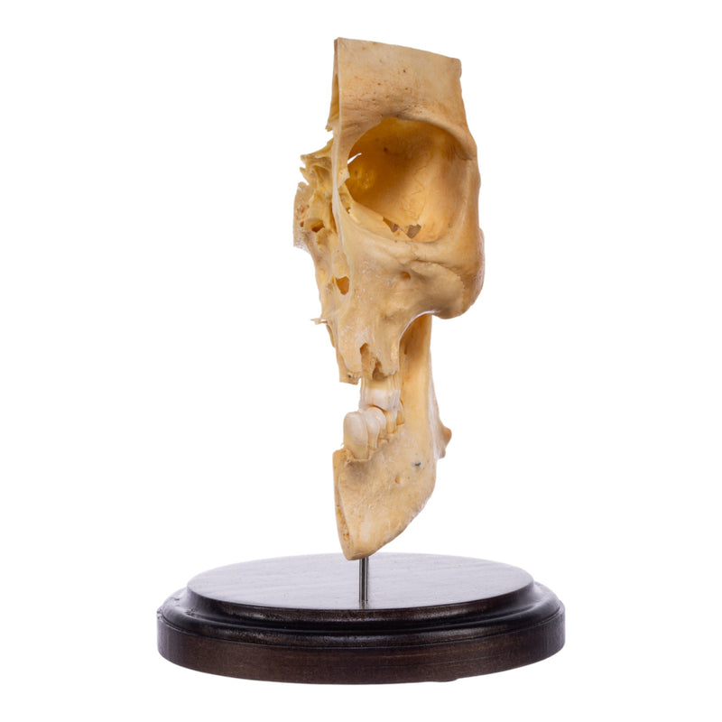 Real Human Partial Skull on Stand