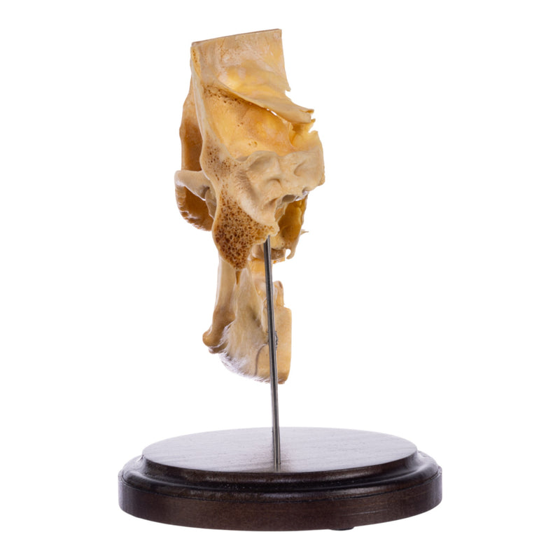 Real Human Partial Skull on Stand