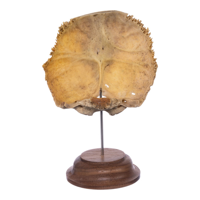 Real Human Partial Skull on Stand