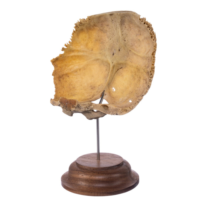 Real Human Partial Skull on Stand