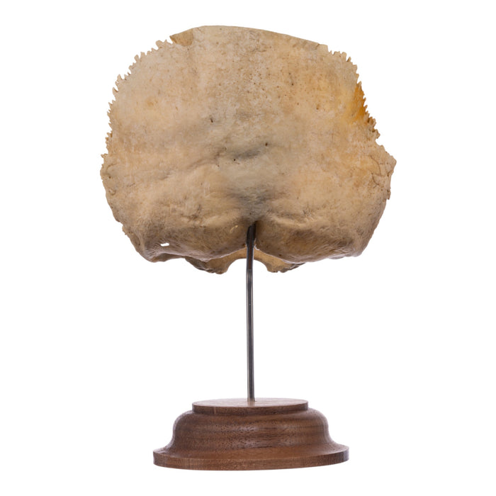 Real Human Partial Skull on Stand