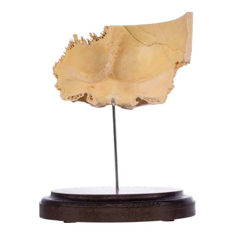 Real Human Partial Skull on Stand