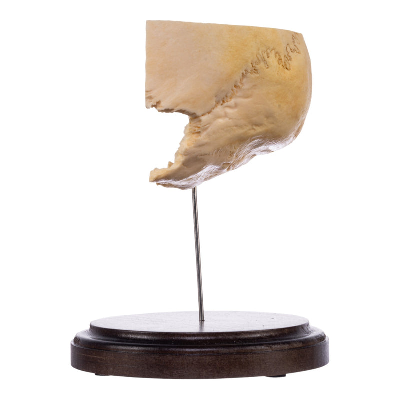 Real Human Partial Skull on Stand