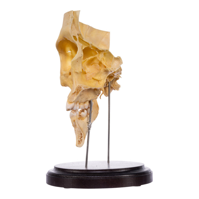 Real Human Partial Skull on Stand