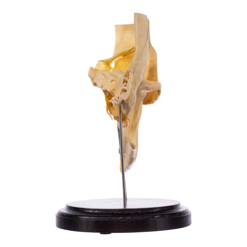 Real Human Partial Skull on Stand