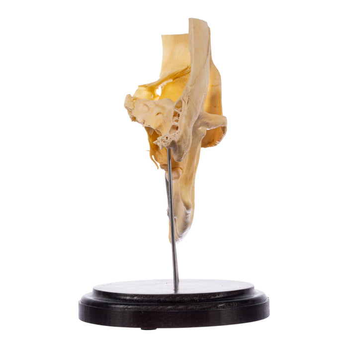 Real Human Partial Skull on Stand