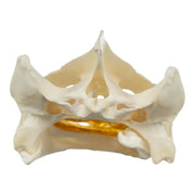 Real Snapping Turtle Skull - Pathology