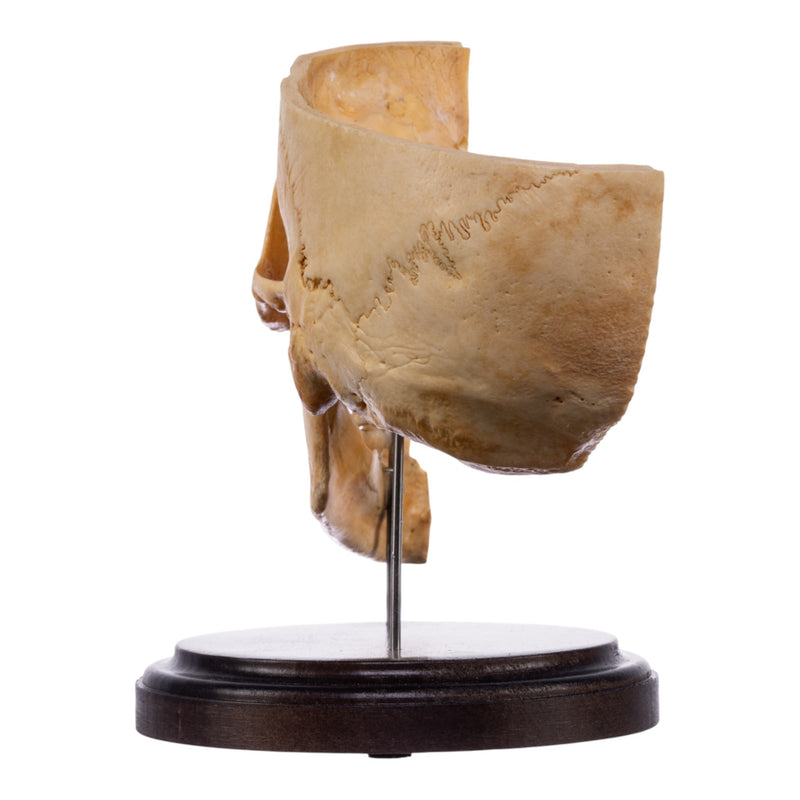 Real Human Partial Skull on Stand