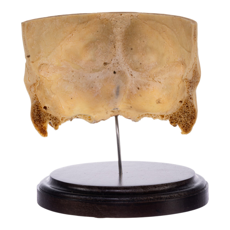 Real Human Partial Skull on Stand