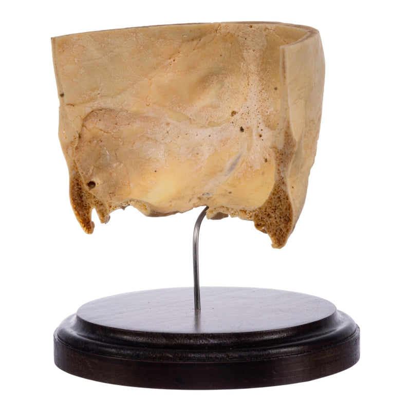 Real Human Partial Skull on Stand