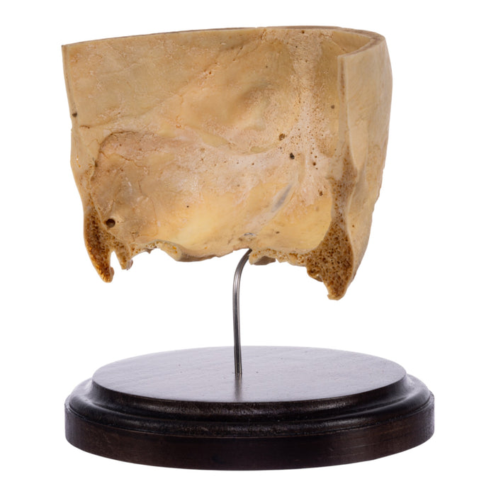 Real Human Partial Skull on Stand