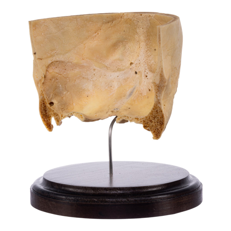 Real Human Partial Skull on Stand