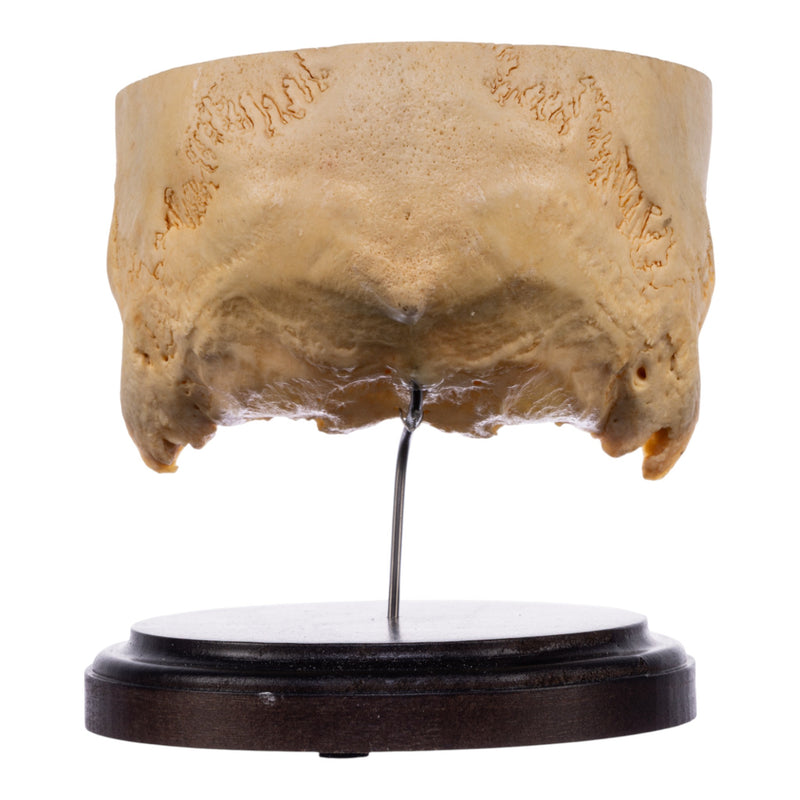 Real Human Partial Skull on Stand