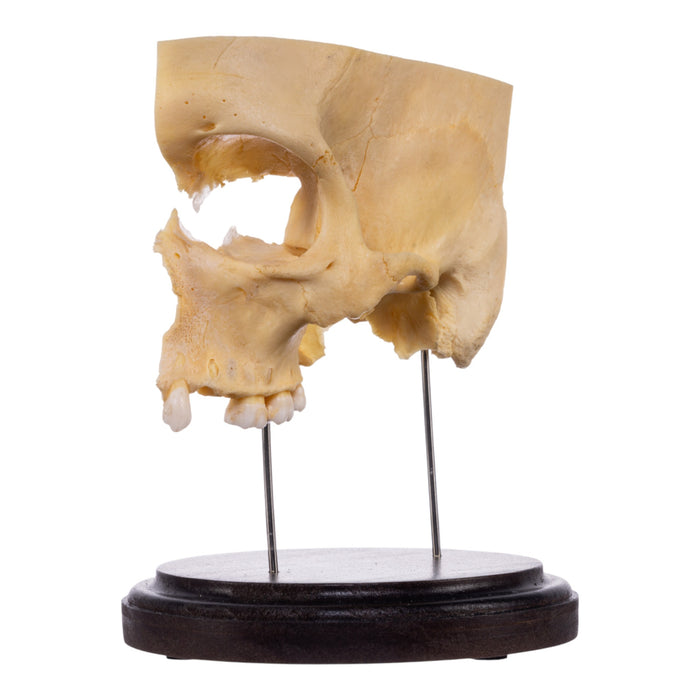 Real Human Partial Skull on Stand