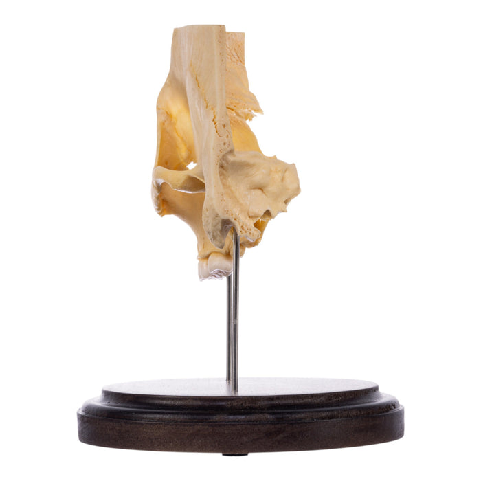 Real Human Partial Skull on Stand