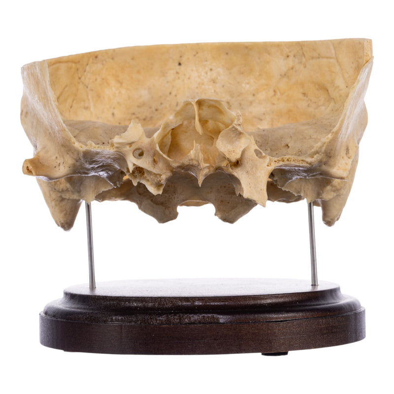Real Human Partial Skull on Stand