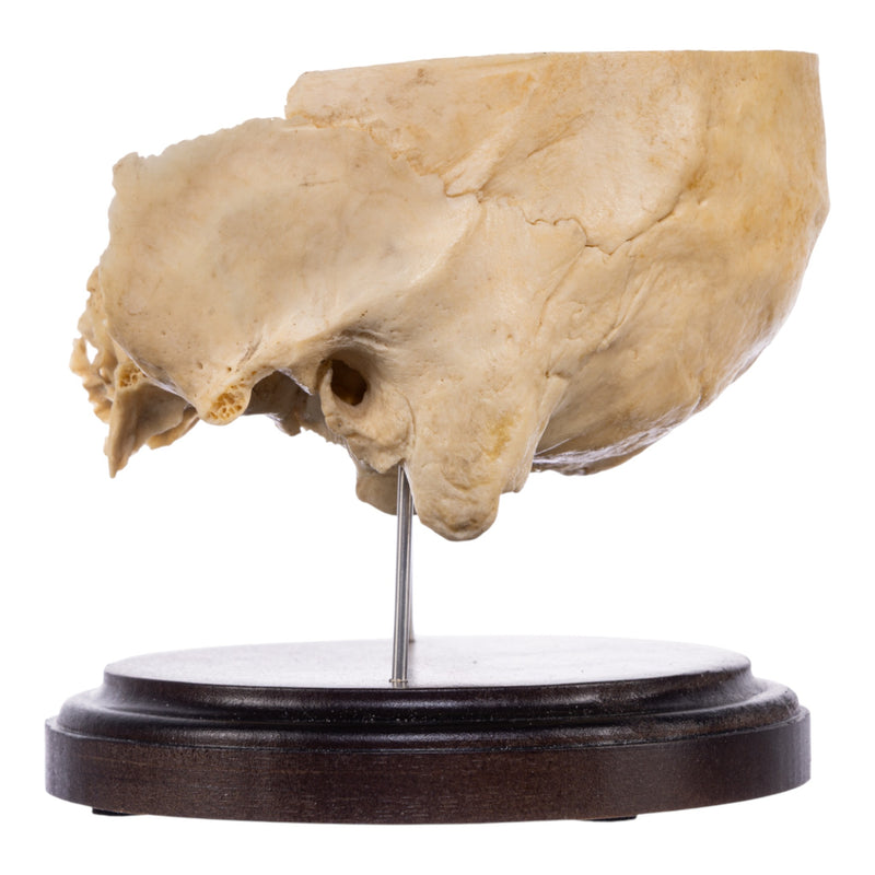 Real Human Partial Skull on Stand