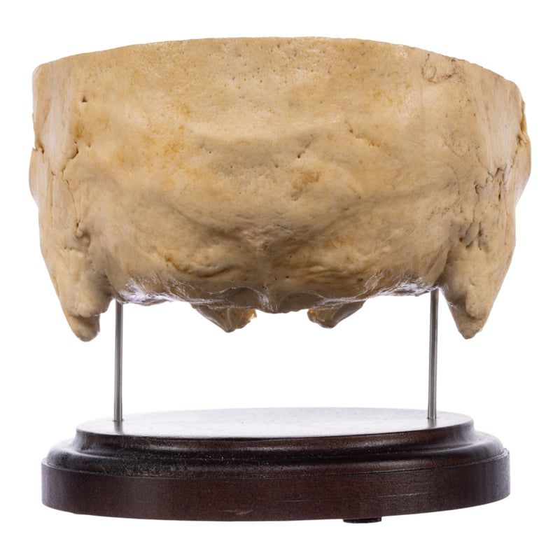 Real Human Partial Skull on Stand
