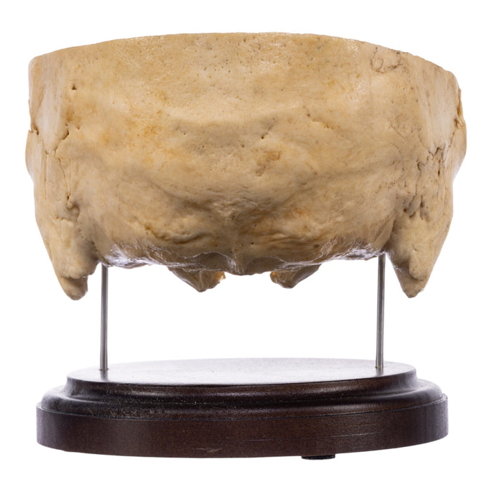Real Human Partial Skull on Stand