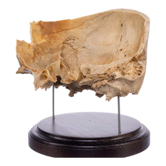 Real Human Partial Skull on Stand