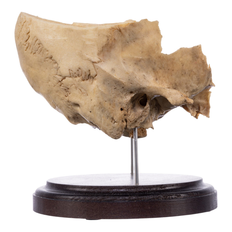 Real Human Partial Skull on Stand